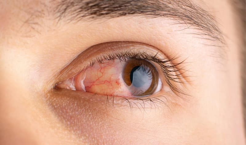 How is Glaucoma Typically Diagnosed and Evaluated?