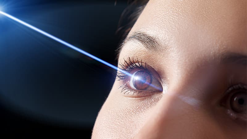 Thinking of LASIK Read This Before You Book Your Surgery