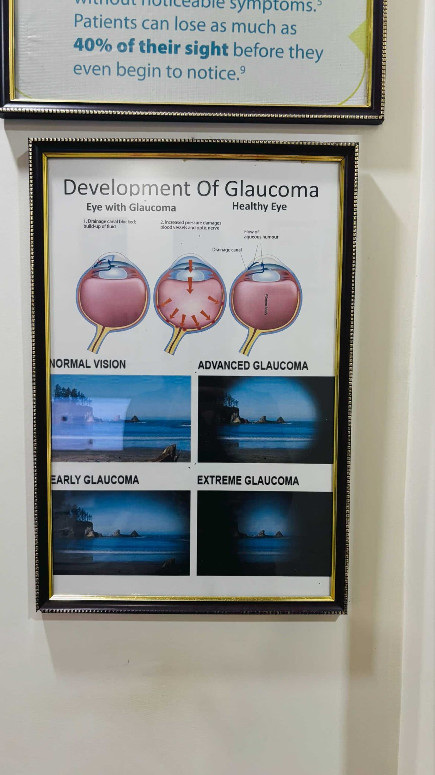 Hospital photograph from the Mungale Eye Hospital gallery