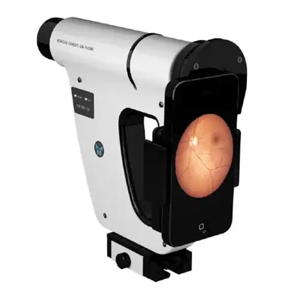 Handheld fundus camera displaying a retinal image