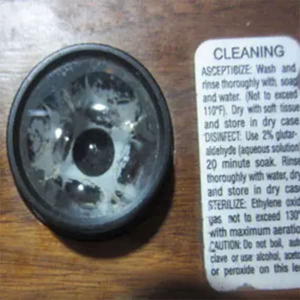 Gonioscopy lens used to examine the eye's drainage angle