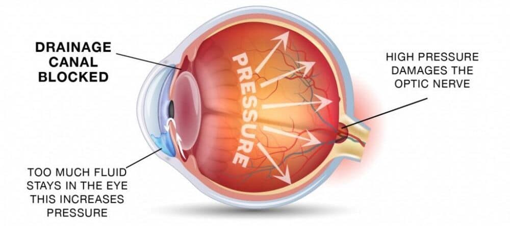 Finding an Eye Hospital Near You: A Practical Checklist